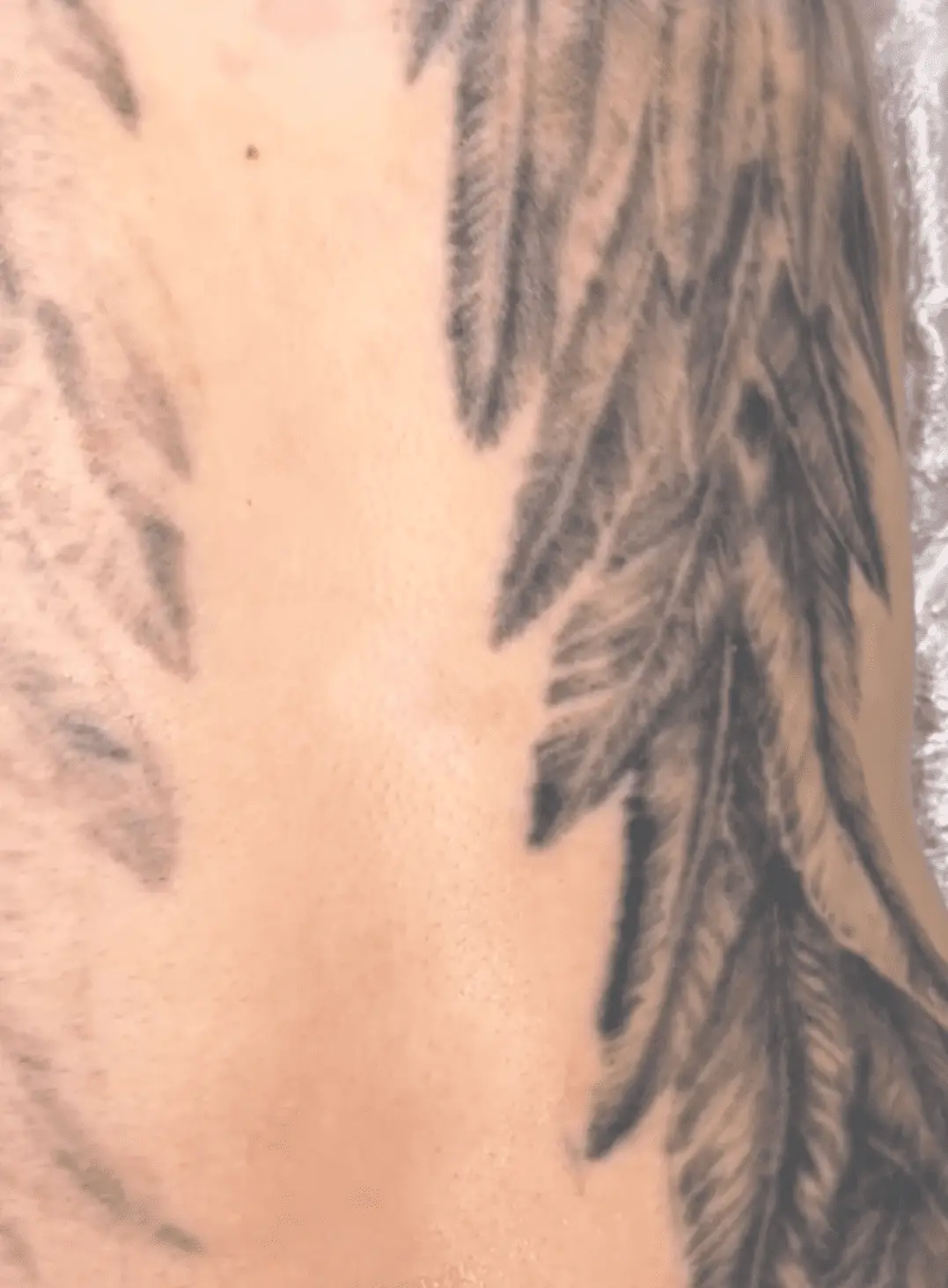 hand tattoo removal before and after
