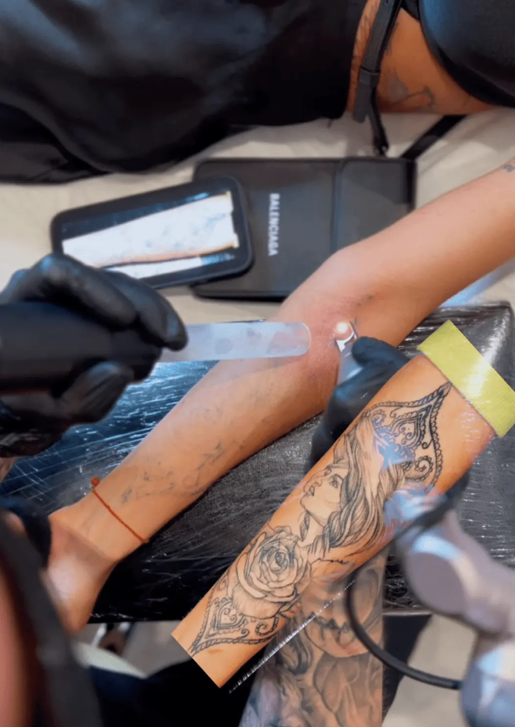 tattoo removal before and after