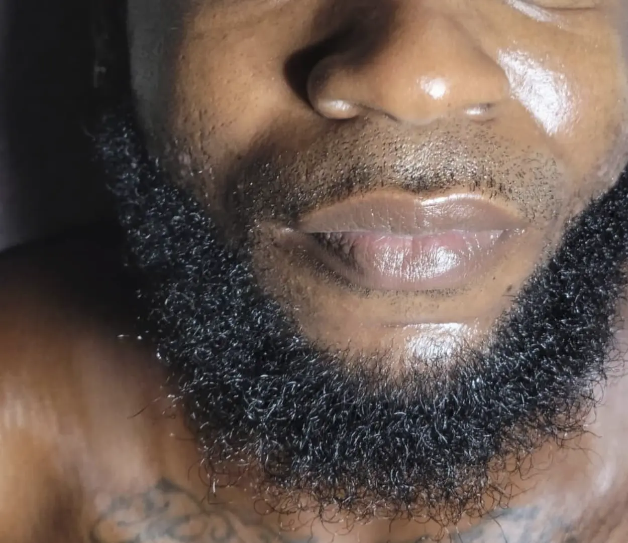 does beard affect hydrafacial treatment results
