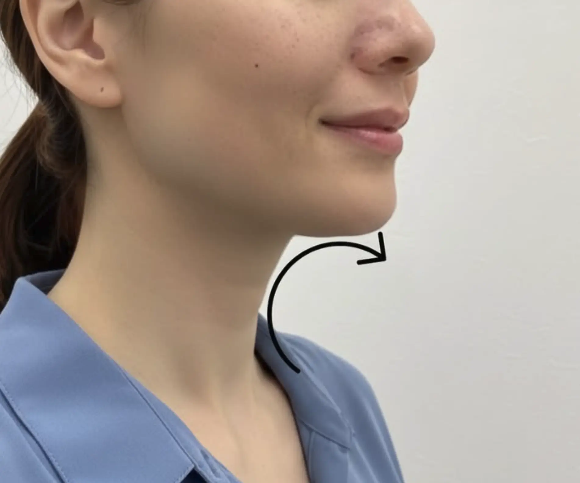 non surgical options for sagging neck after weight loss