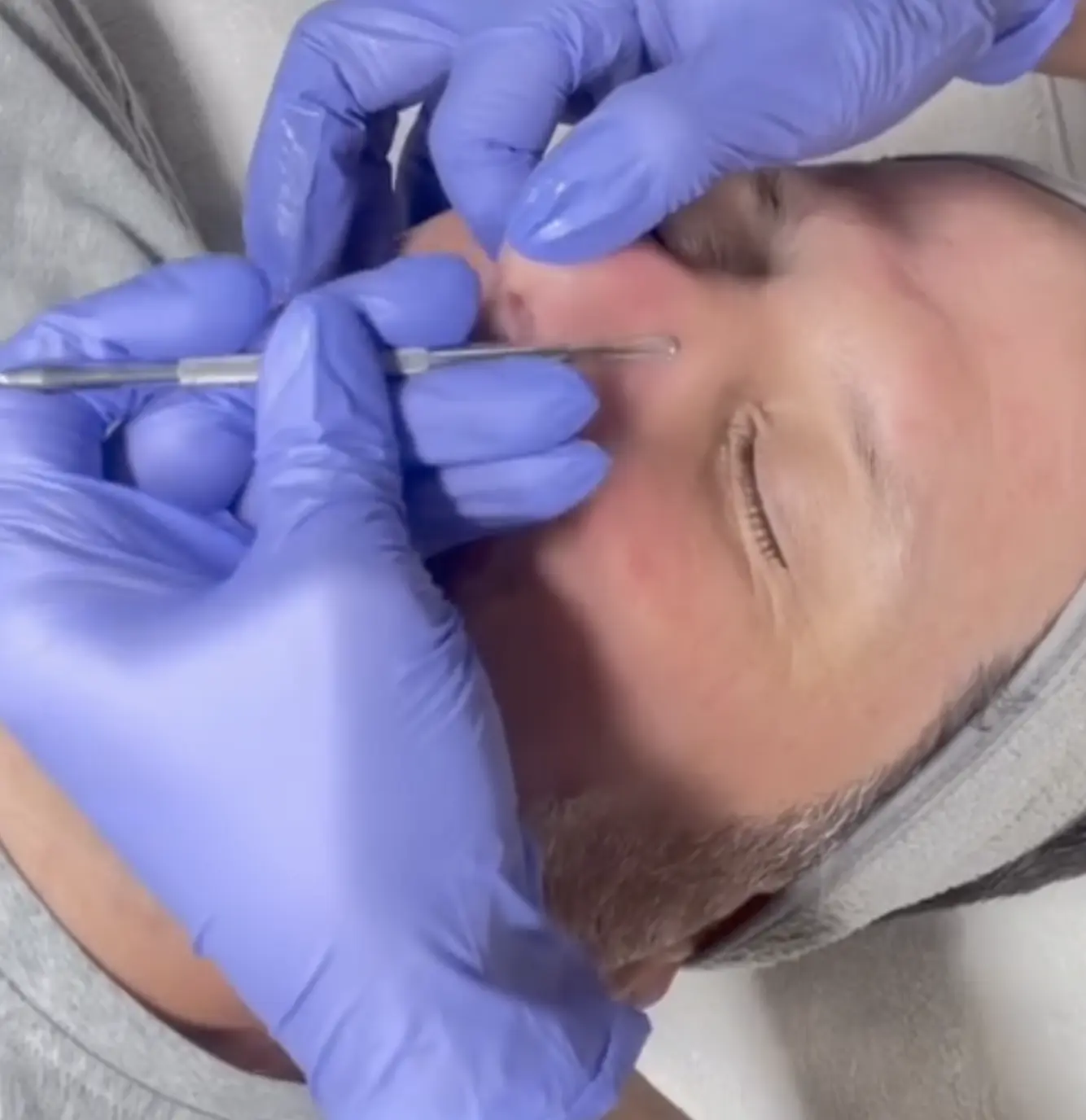 skincare treatments for men with beards